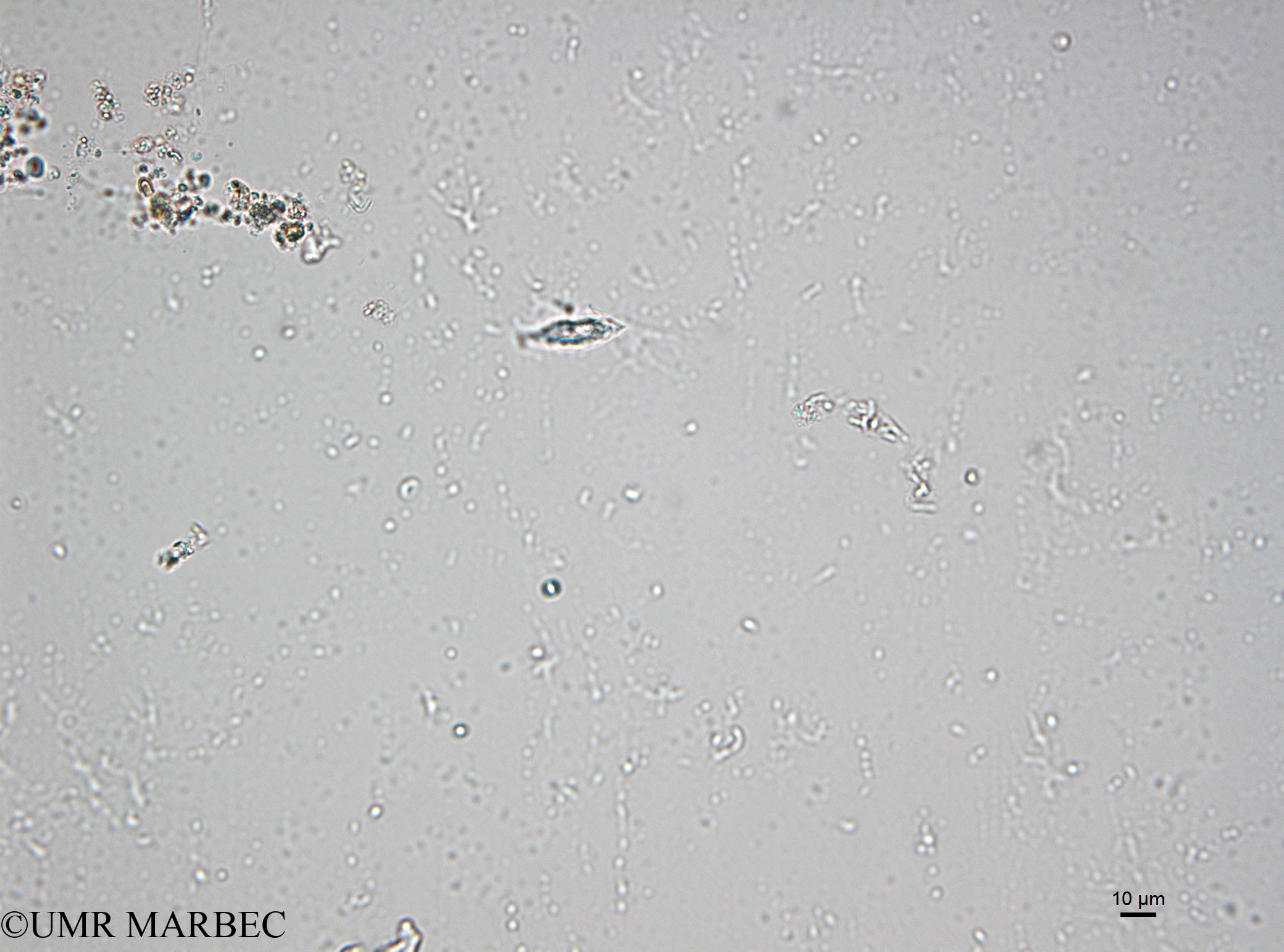 phyto/Bizerte/bizerte_lagoon/RISCO April 2014/Lessardia elongata (ancien Gyrodinium sp3 -ancien G. spirale -150407_001_ovl-4).tif(copy).jpg